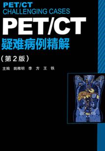 贫血症状男人